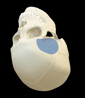 slide_0001_Pterional