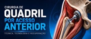 cirurgia de quadril por acesso anterior