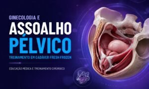 Treinamento em assoalho pélvico com cadáver fresh frozen na ginecologia cirúrgica.