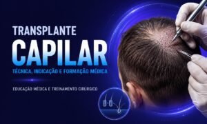 transplante capilar com planejamento médico e técnica cirúrgica