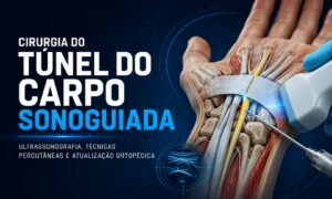 cirurgia do túnel do carpo sonoguiada