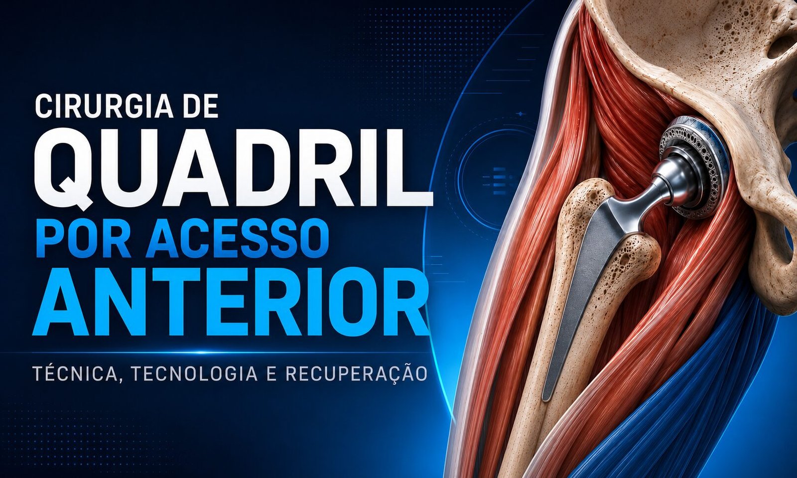 cirurgia de quadril por acesso anterior