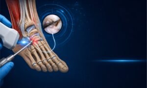 Cirurgia de pé e tornozelo com treinamento médico, anatomia aplicada e tecnologia ortopédica