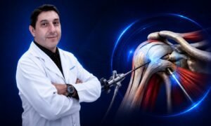 Artroscopia de ombro com ilustração anatômica, instrumentais cirúrgicos e Dr. José Carlos Garcia Jr.