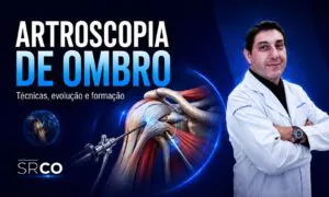 Artroscopia de ombro com ilustração anatômica, instrumentais cirúrgicos e Dr. José Carlos Garcia Jr.